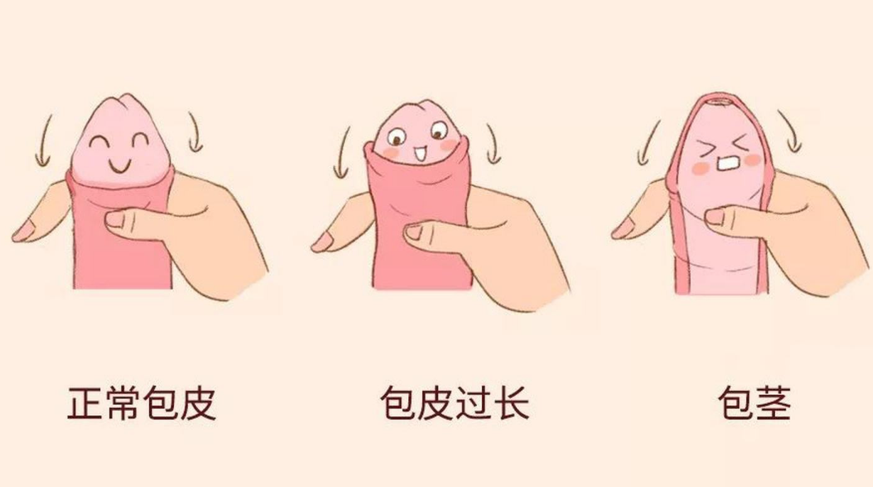 20�����Ӱ�Ƥ�����������»���